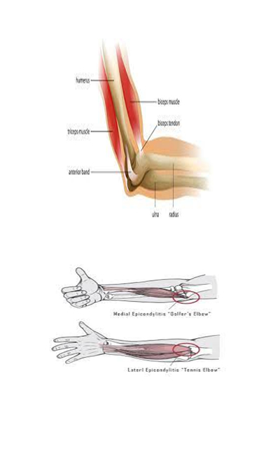 elbow diagram